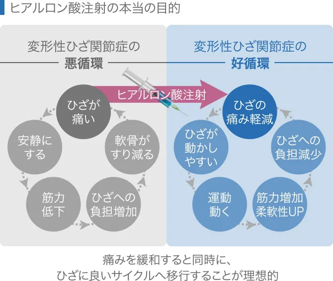 ヒアルロン 酸 注射 肩