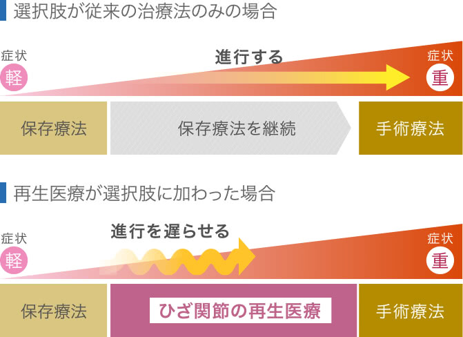 再生医療法と保存治療法との比較