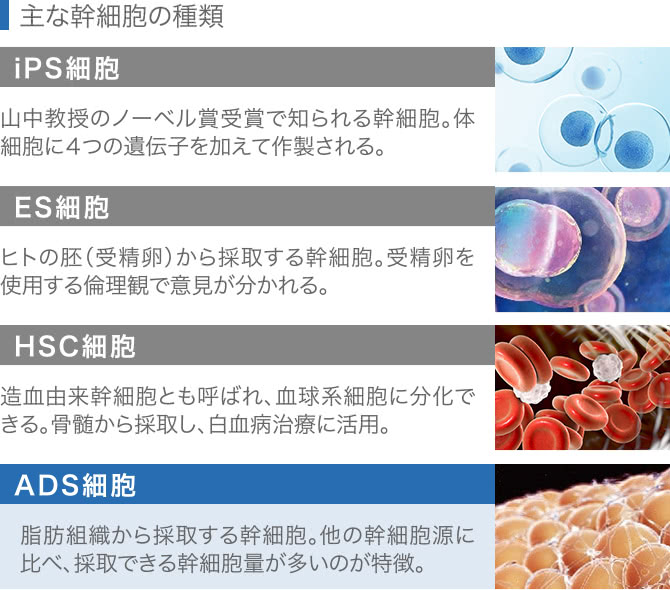 幹細胞の種類